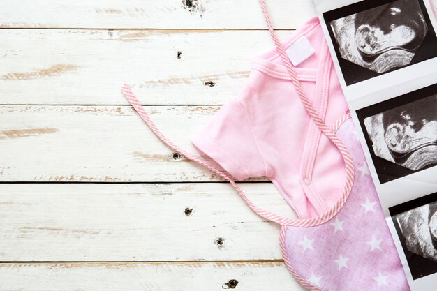 Pink baby romper and ultrasound on white wooden background with copy space