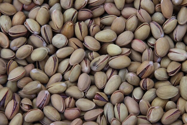 Pistachio's