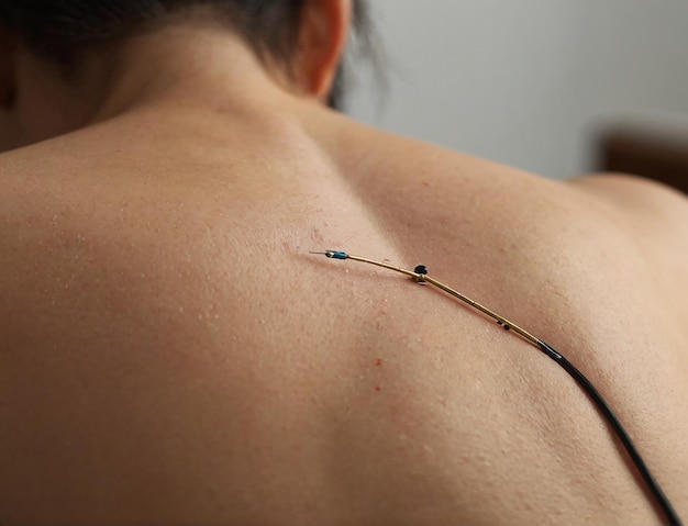 placing acupuncture in a relaxed space