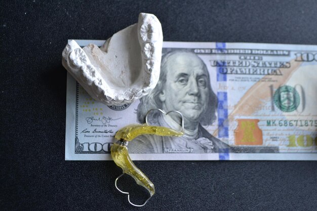 Plaster cast of teeth and dental plate on the background of money and dental xray dental examination