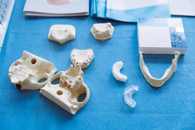 A plastic model of the jaw for prosthetics