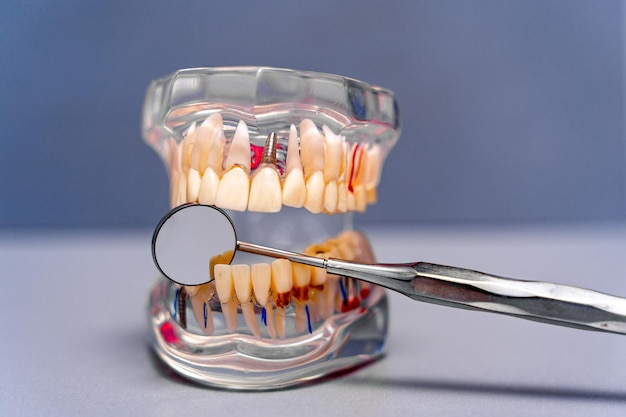 Plastic model van de kaak voor protheses in de tandheelkunde en maxillofaciale chirurgie ligt op een witte tafel met tandheelkundige spiegel.