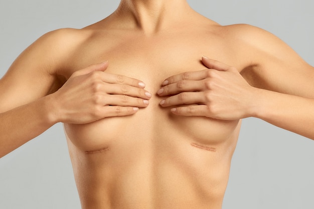 Plastic surgery of the female breast