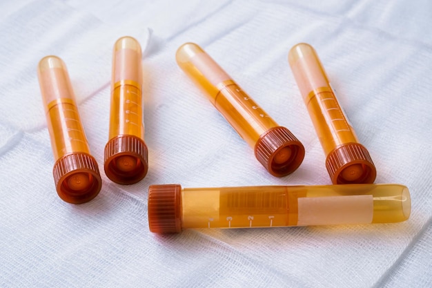 Plastic test tubes with caps for the collection of samples Blood sampling tubes