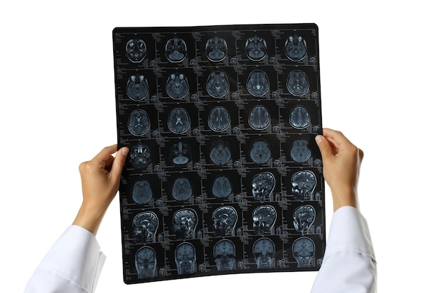 흰색 배경에 고립된 의사의 손에 있는 인간 머리의 PNG MRI 이미지