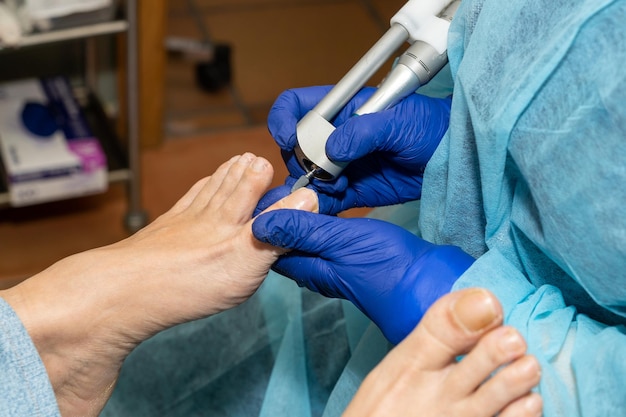 Podiatrist works carefully on her patient's toenails with a medical emery board Medical pedicure