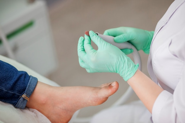 Podiatry doctor preparing the tool