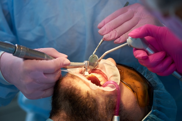 Polishing teeth patient using cofferdam. Doctor and assistant in pink gloves. Dental services in modern clinic. Close-up