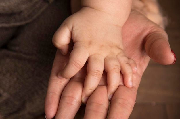 Photo polydactyly baby hand genetic condition