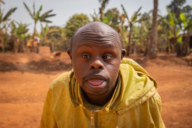 Premium Photo  Portrait of an adult bald african man with down syndrome on  a forest background