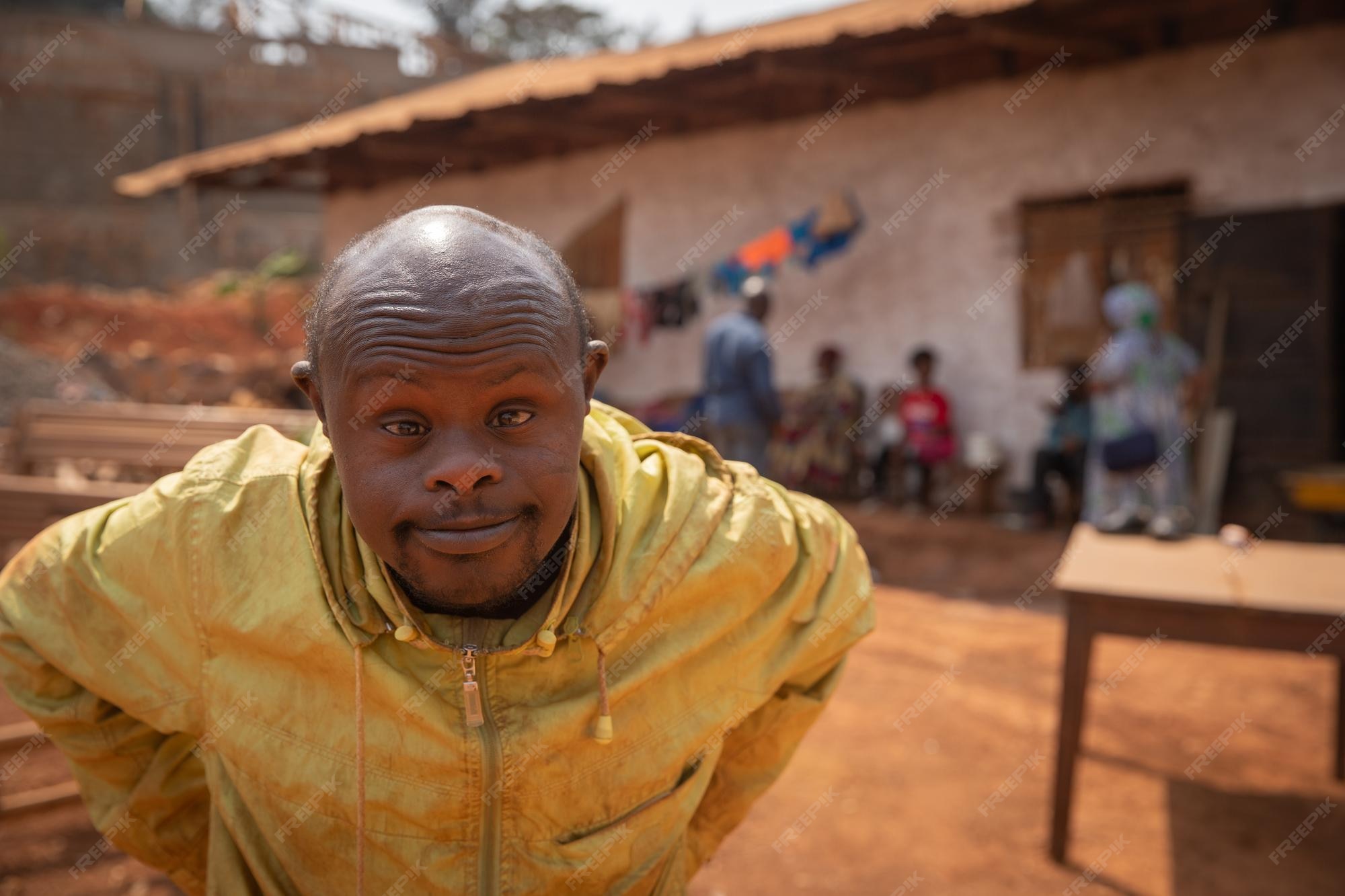 Premium Photo | Portrait of an african man with down syndrome is in an