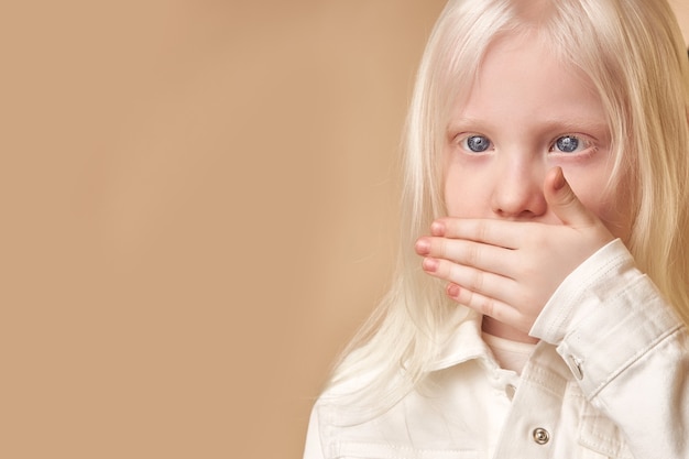 Portrait of albino kid girl with white skin and white hair