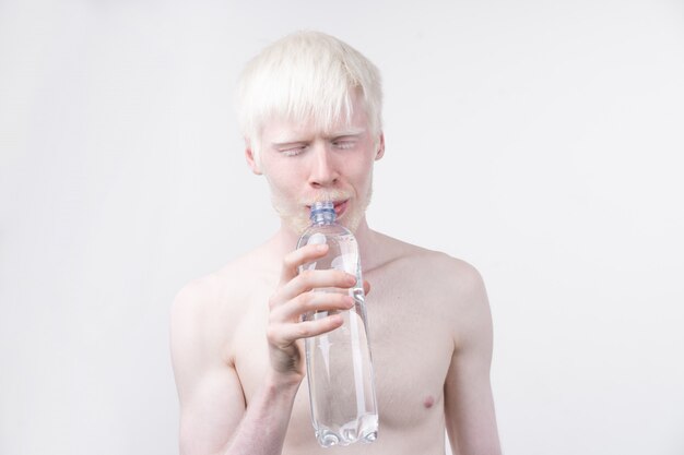 Portrait of an albino man drinking water