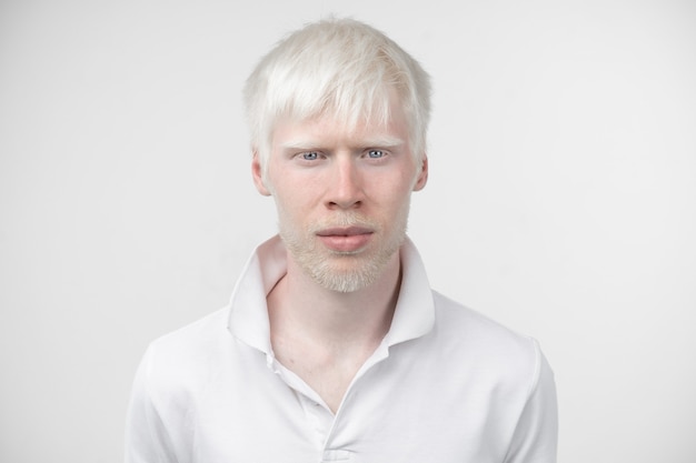 Portrait of an albino man in  studio dressed t-shirt isolated on a white background. abnormal deviations. unusual appearance. skin abnormality