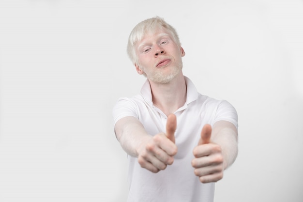 Portrait of an albino man in a studio