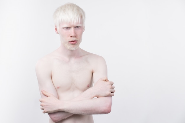 Portrait of an albino man in a studio