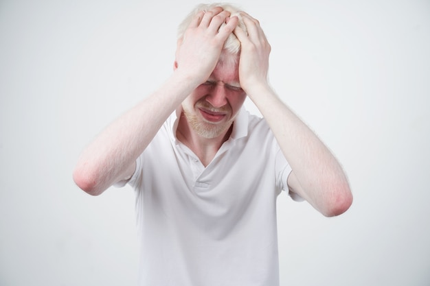 Portrait of an albino man in a studio