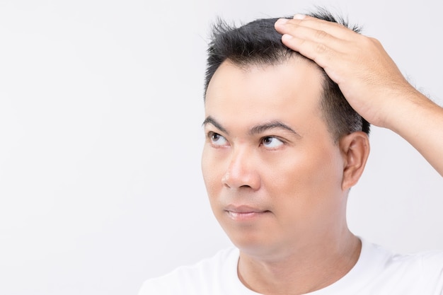 Portrait Asian man with worry feeling and touching on his head to show bald head or Glabrous problem