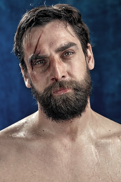 Portrait of a bearded man with a split eyebrow and
forehead