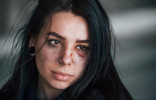 Portrait of beaten young woman with bruise under eye indoors in\
abandoned building