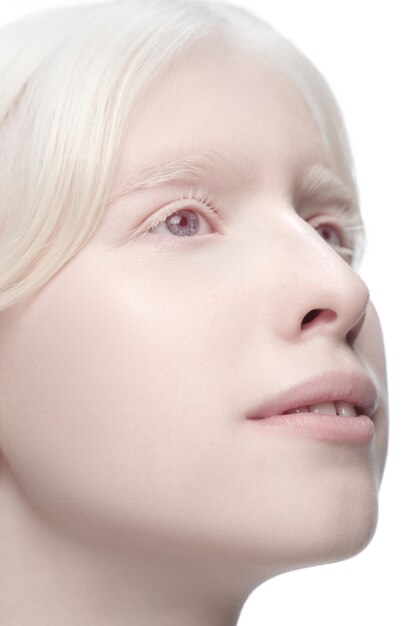 Portrait of beautiful albino woman isolated on white studio background.