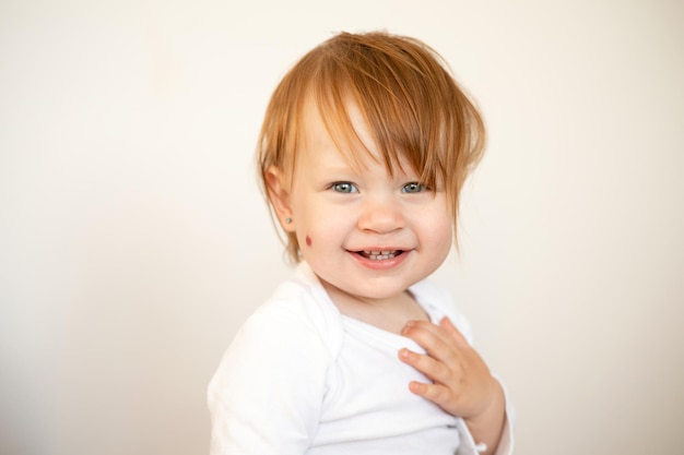 Portrait of a charming funny redhaired baby girl with blue eyes and a birthmark on her cheek Hemangioma Light background Lifestyle