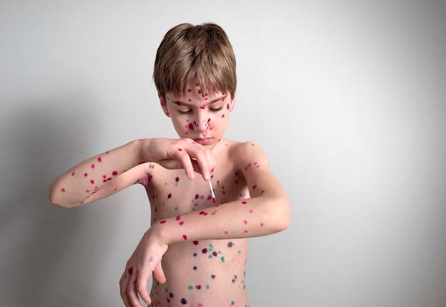 Photo portrait of an emotional little boy with chicken pox on the background of a gray wall