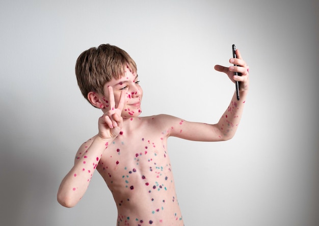 Portrait of an emotional little boy with chicken pox on the background of a gray wall