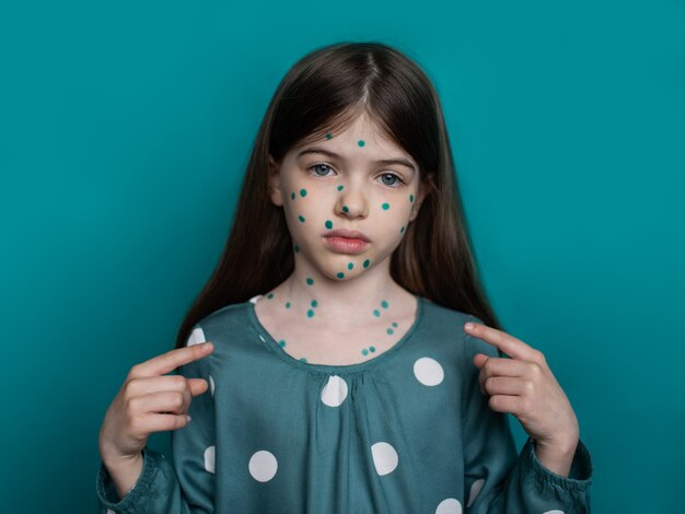 portrait of a girl suffering from chickenpox