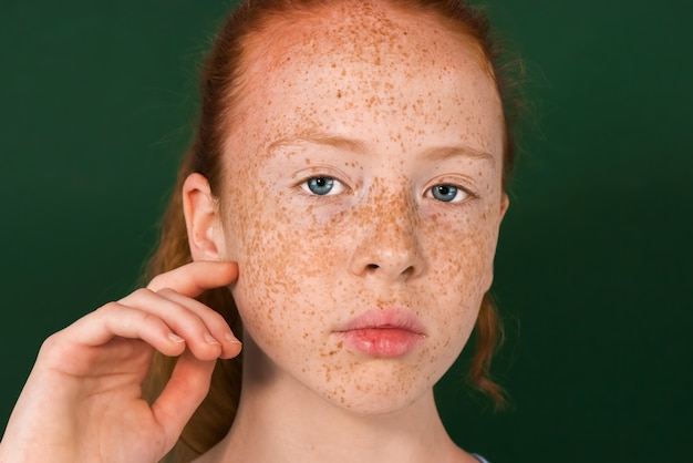 Portrait of a girl with blue eyes and red hair touching her face full of freckles