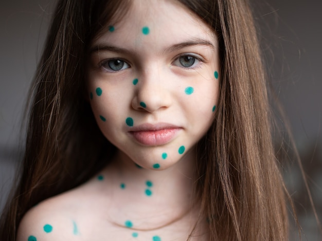 portrait of a girl with chickenpox