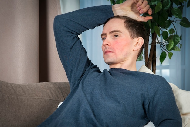 Portrait of ill sick guy young man with red face suffering from heat fever high temperature holding