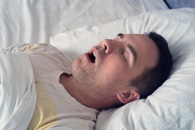 照片肖像张大嘴巴的男人睡觉打鼾睡眠问题一个年轻可爱的家伙睡觉的床上一个白色的白天还是早上