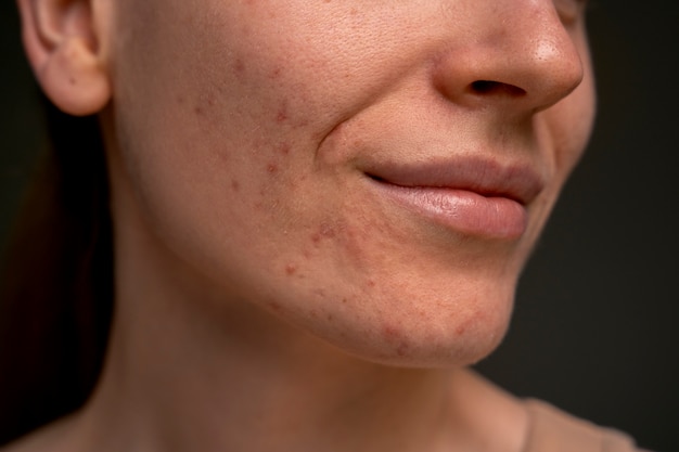 Portrait of person with dermatitis skin condition