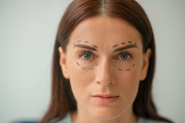 portrait picture of a woman with lines in the eyes area