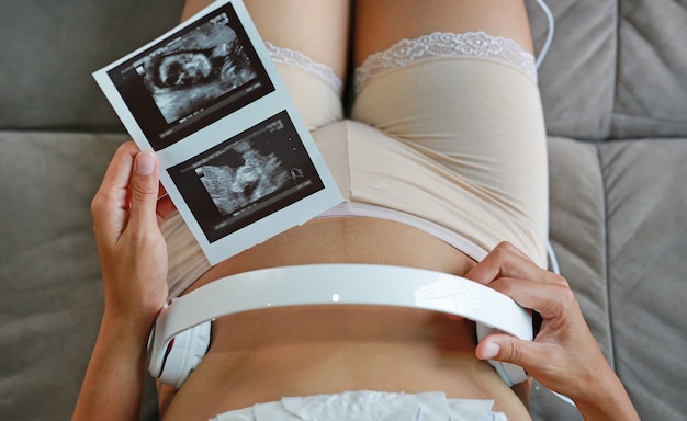 Portrait of pregnant woman sitting on sofa at home holding ultrasound film 