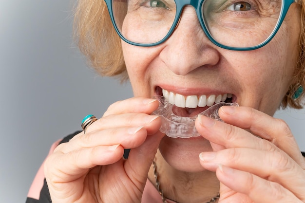 Foto ritratto di una donna anziana che tiene in mano un allineatore dentale