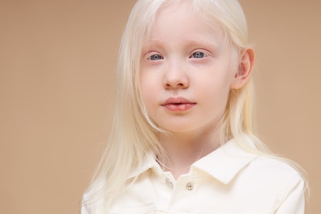 Portrait of smiling albino child girl isolated