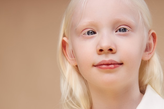 Portrait of smiling albino child girl isolated