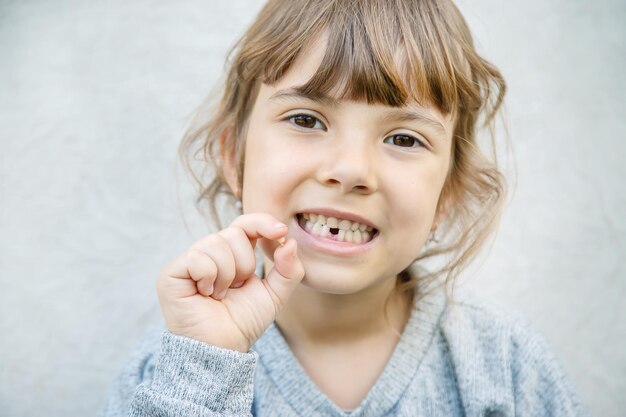 Foto ritratto di una ragazza sorridente con un dente rotto