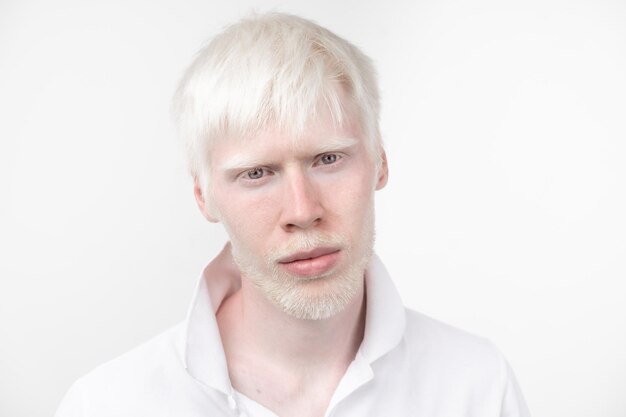 Photo portrait of young man with albino against white background