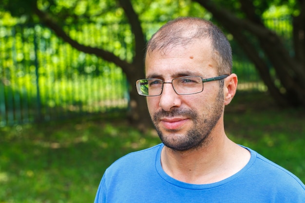 Portrait of young man with bad eyesight and hair loss.