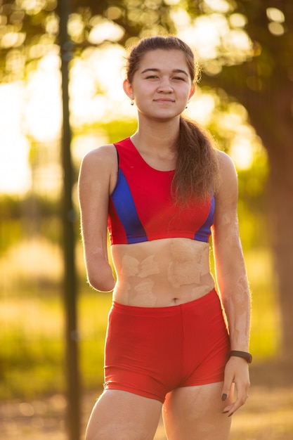 Портрет молодой женщины-спортсмена с ампутированной рукой и ожогами на ее теле.