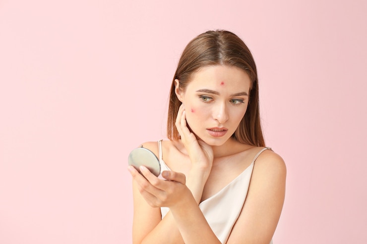 Photo ピンクの鏡で見ているにきびの問題を持つ若い女性の肖像画