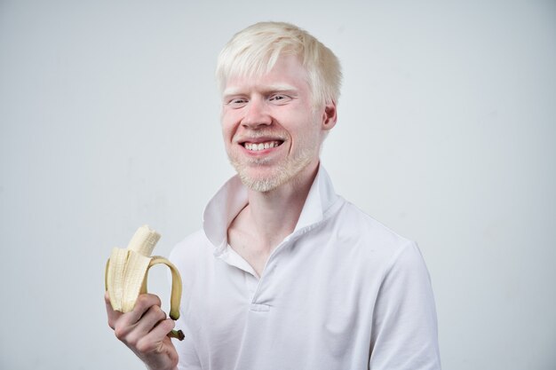 Portret van een albinoman die een banaan houdt