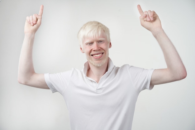 Portret van een albinoman in een studio