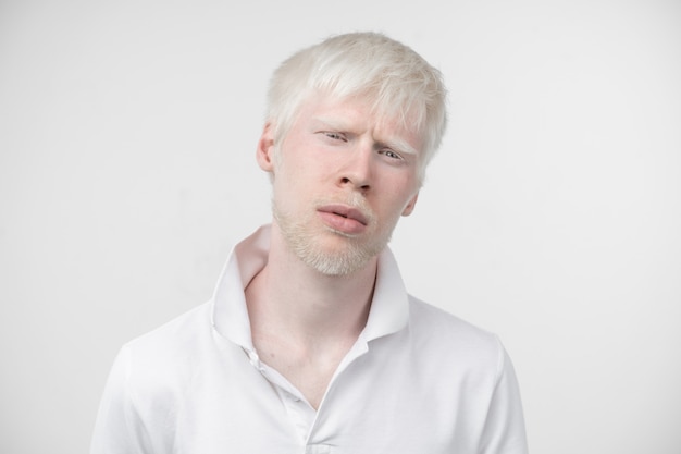 Portret van een albinomens in studio geklede die t-shirt op een witte achtergrond wordt geïsoleerd. abnormale afwijkingen. ongewoon uiterlijk. huidafwijking