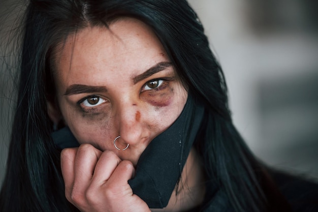 Portret van een geslagen jonge vrouw met een zwart beschermend masker met blauwe plekken onder het oog binnenshuis in een verlaten gebouw