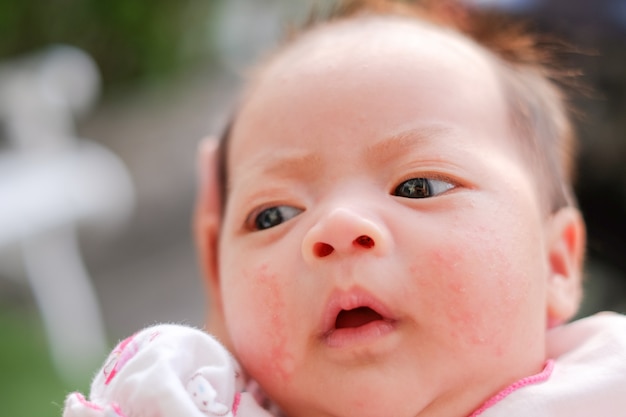 Portret van een pasgeboren baby close-up. gezicht babyuitslag