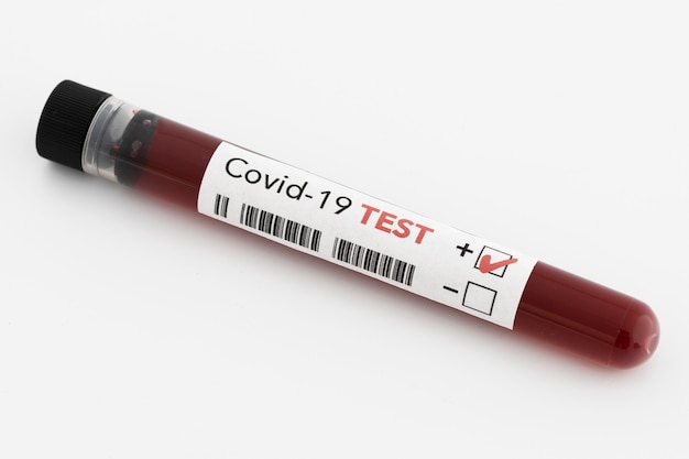 Positive blood test result on white background
